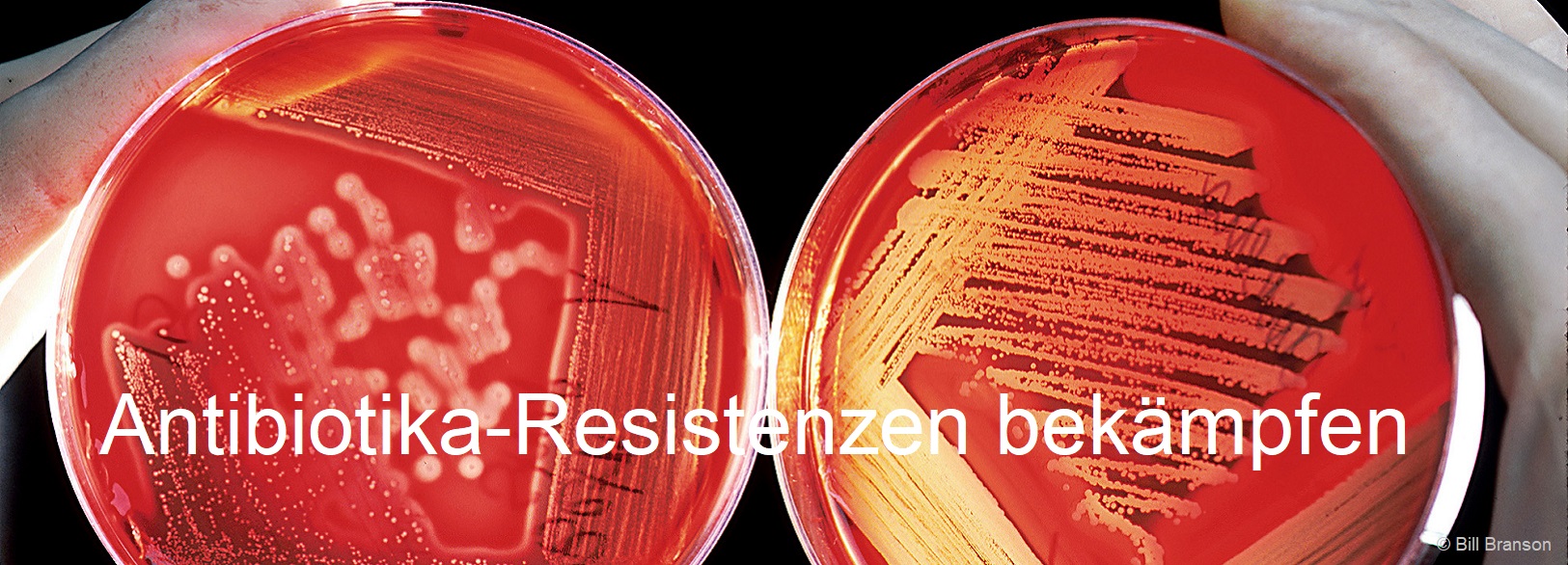Antibiotika Resistenzen Bill BransonUSDepartment of HealthAgarplate redbloodcells Staphylococcus