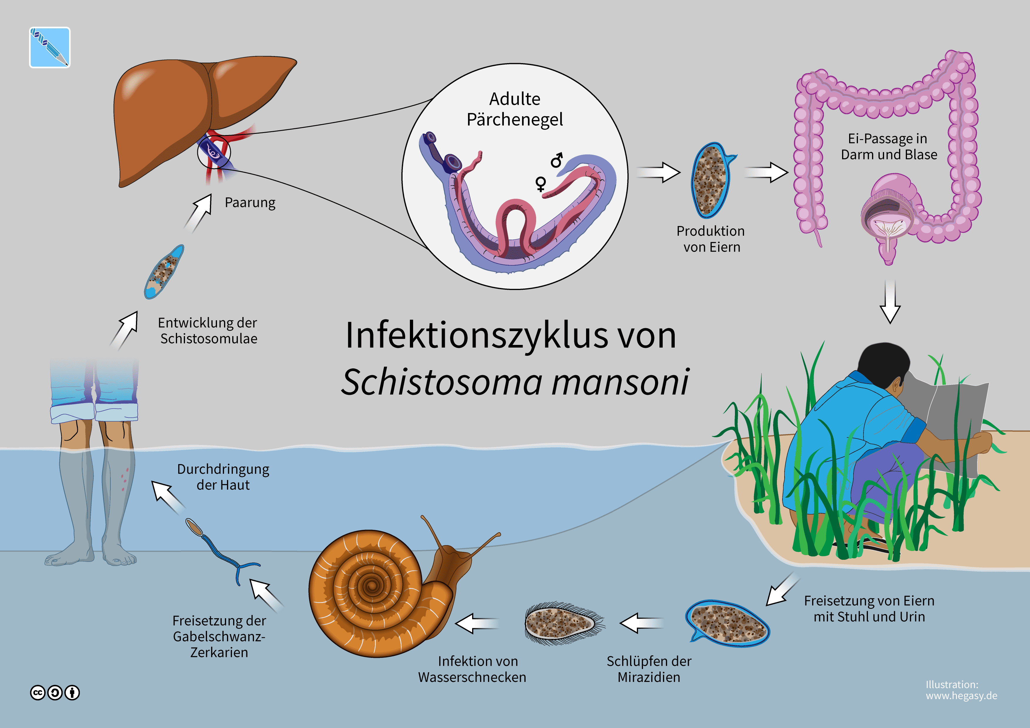 Schistosomiasis-Schaubild