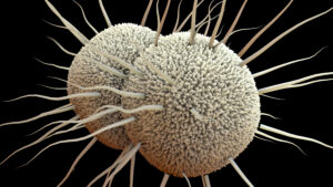 Mikroskopische Aufnahme von Neisseria gonorrhoeae, dem bakteriellen Erreger von Gonorrhö.